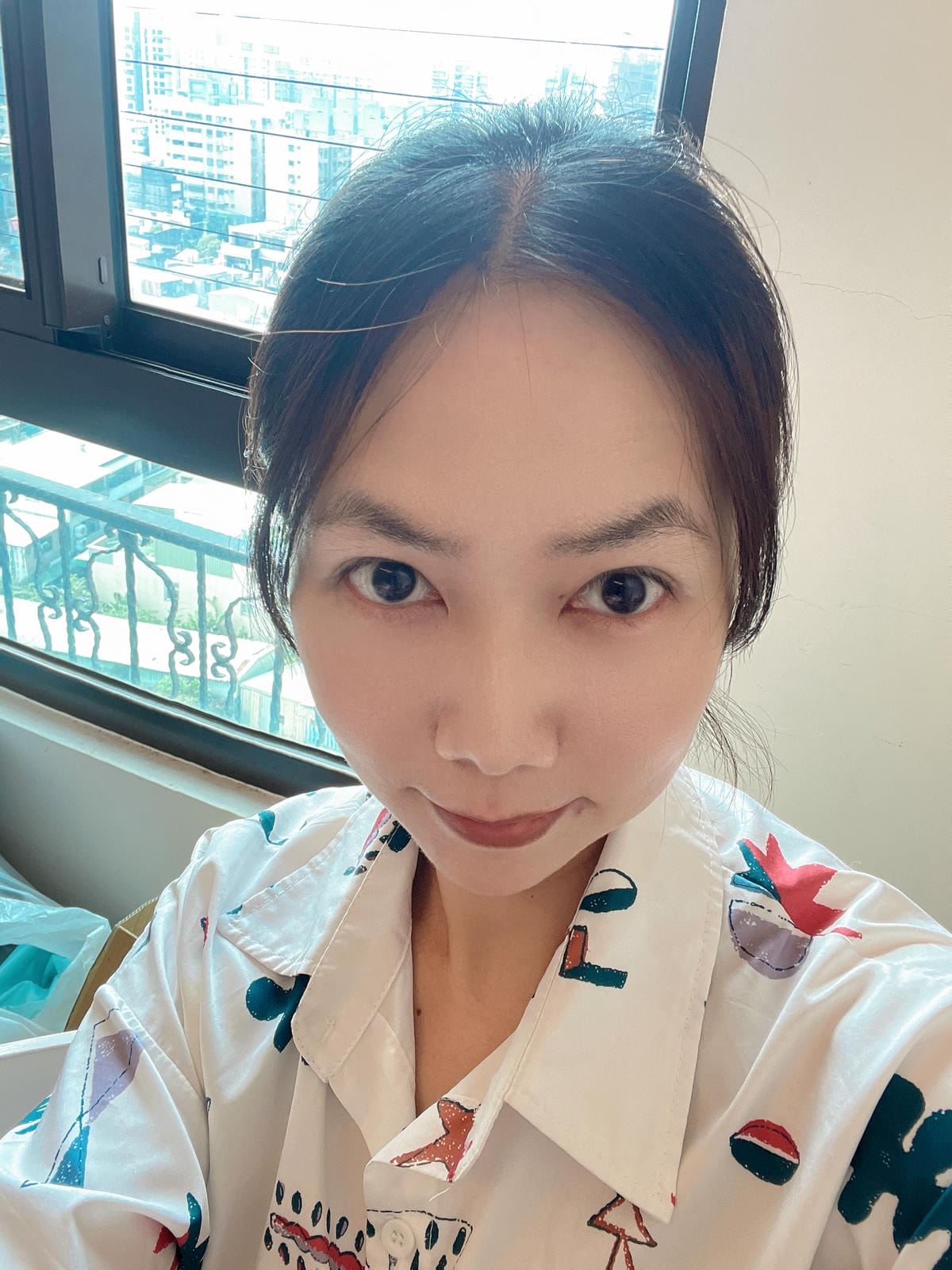 抬頭紋消失術 彩虹肉毒除皺瘦小臉 ┃中山淨妍醫美診所 - 第5張圖